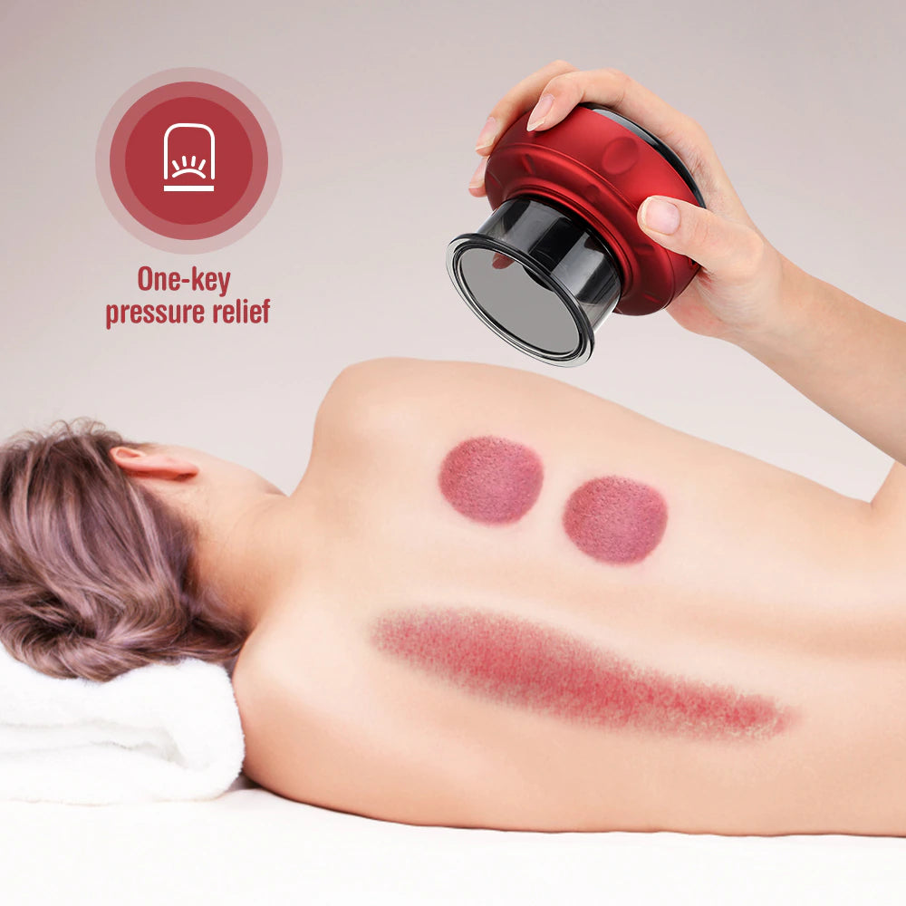 Electric Cupping Device