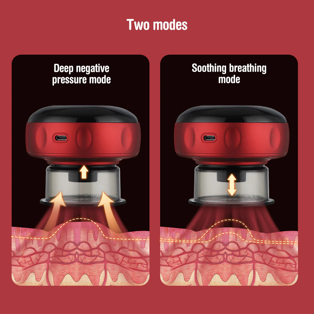 Electric Cupping Device